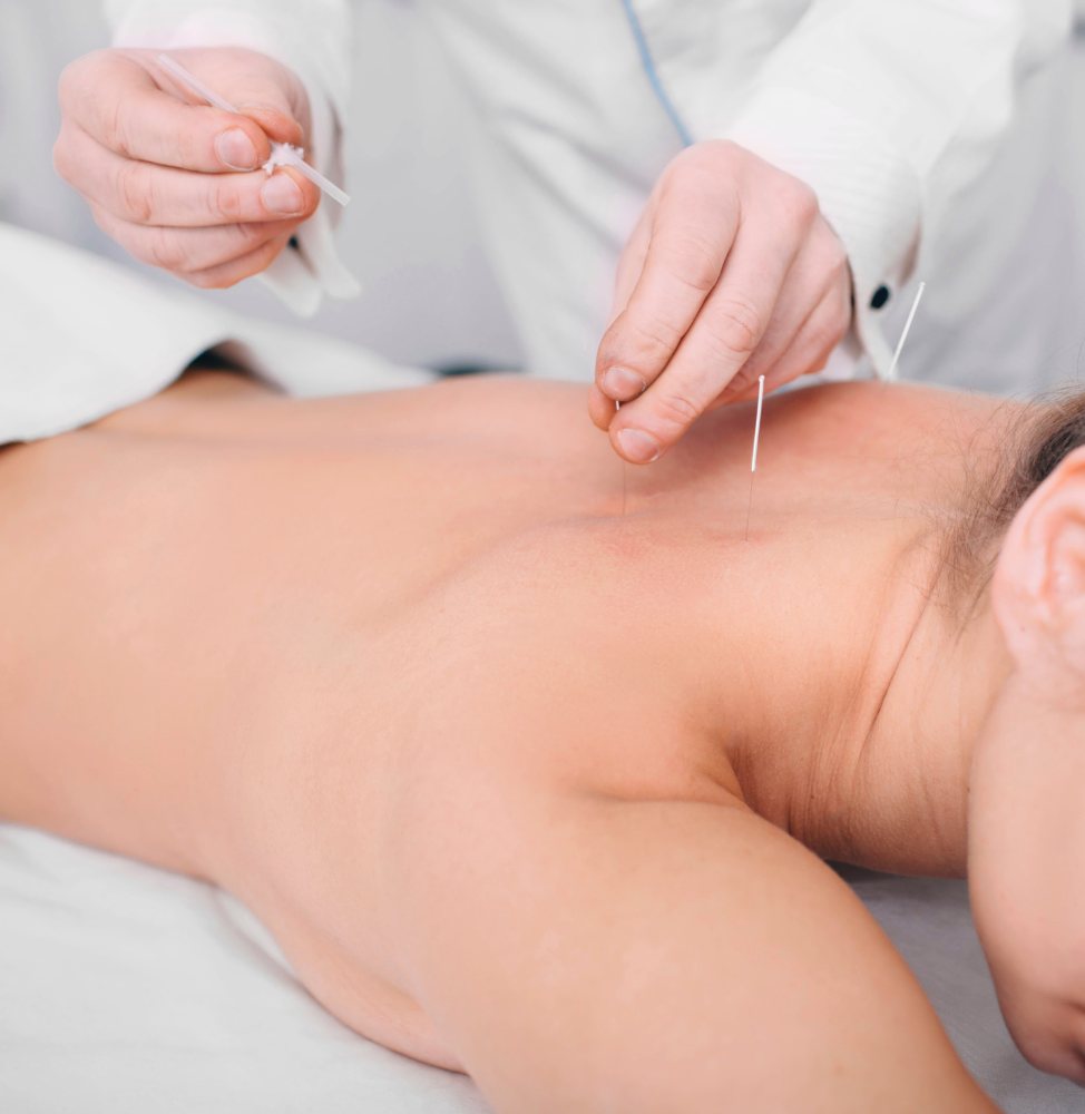 agopunutura-medica