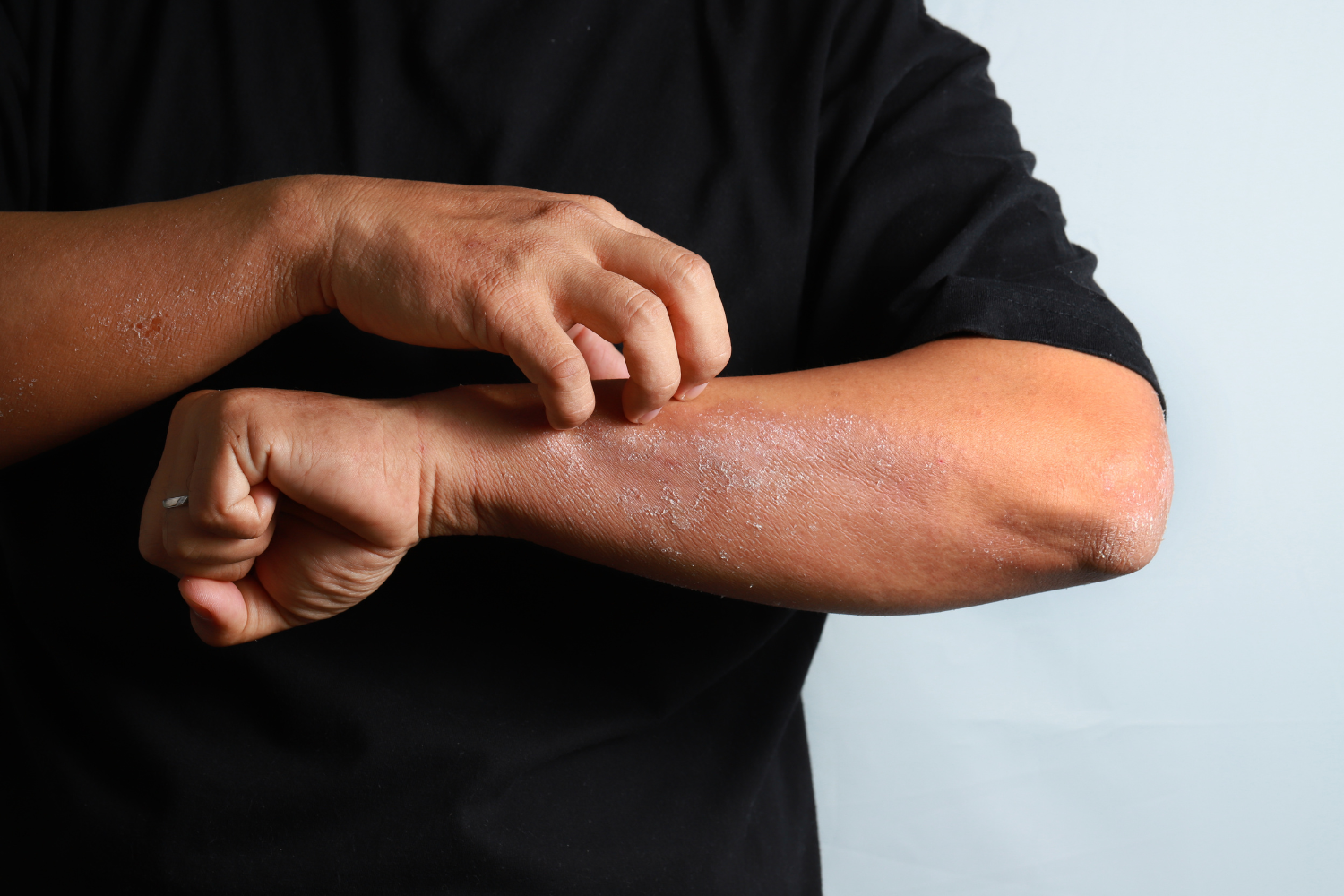 prurito-dermatologico