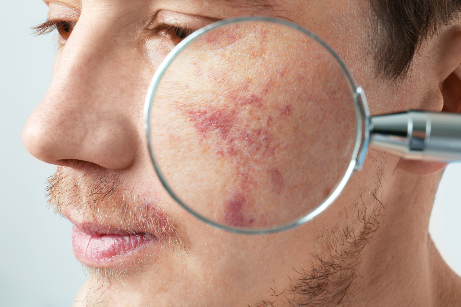 problema-dermatologico