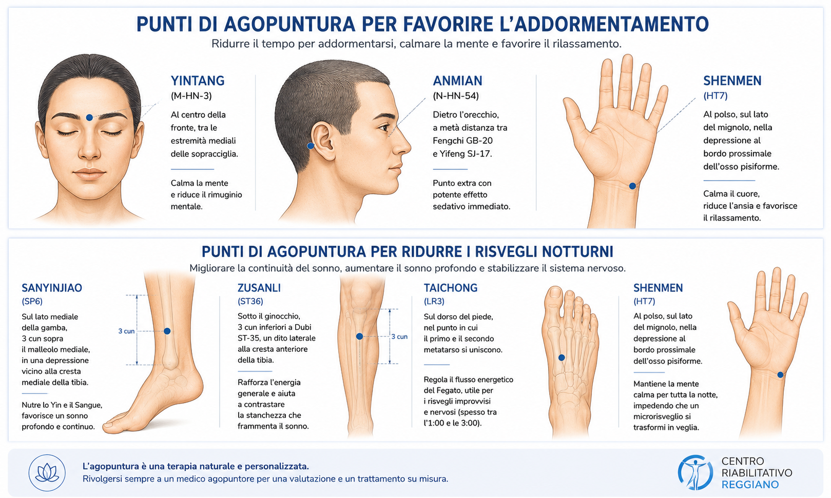 agopuntura-punti